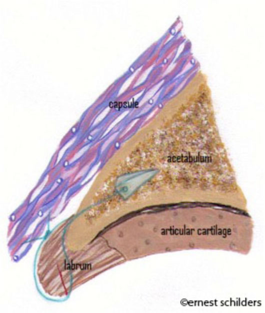 Arthroscopic repair of labral tear